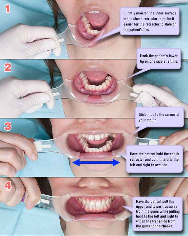 Oral standard photography (5-sheet method) taken with Ring Flash MF18